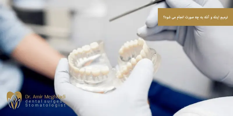 ترمیم اینله و آنله به چه صورت انجام می شود؟