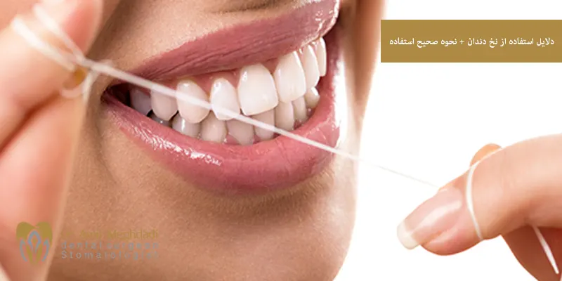 دلایل استفاده از نخ دندان + نحوه صحیح استفاده