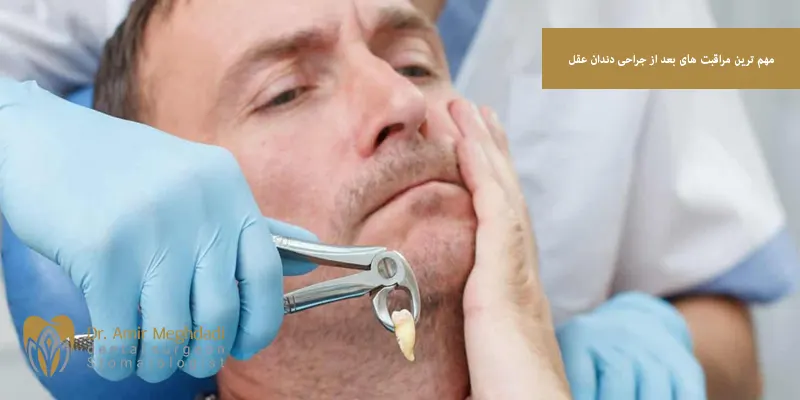 مهم ترین مراقبت های بعد از جراحی دندان عقل