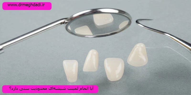 محدودیت-سنی-برای-لیمنت-شیشه-ای