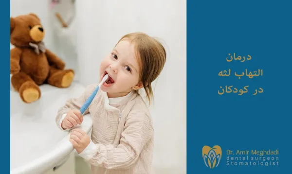 التهاب لثه در کودکان -ژنژویت
