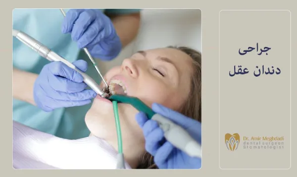 جراحی-دندان-عقل