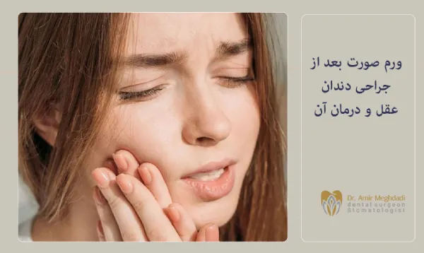 ورم-صورت-بعد-از-جراحی-دندان-عقل-و-درمان-آن