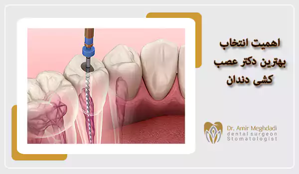 اهمیت انتخاب بهترین دکتر عصب کشی دندان؟