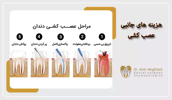 هزینه های جانبی عصب کشی