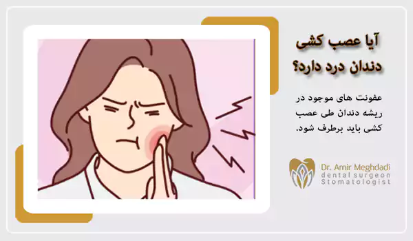 آیا عصب کشی دندان درد دارد؟