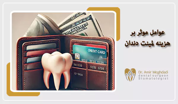عوامل موثر بر هزینه لمینت دندان