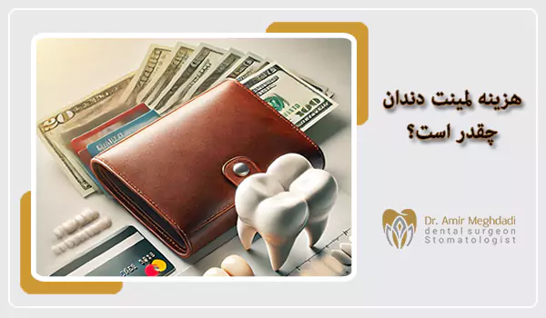 هزینه لمینت دندان چقدر است؟